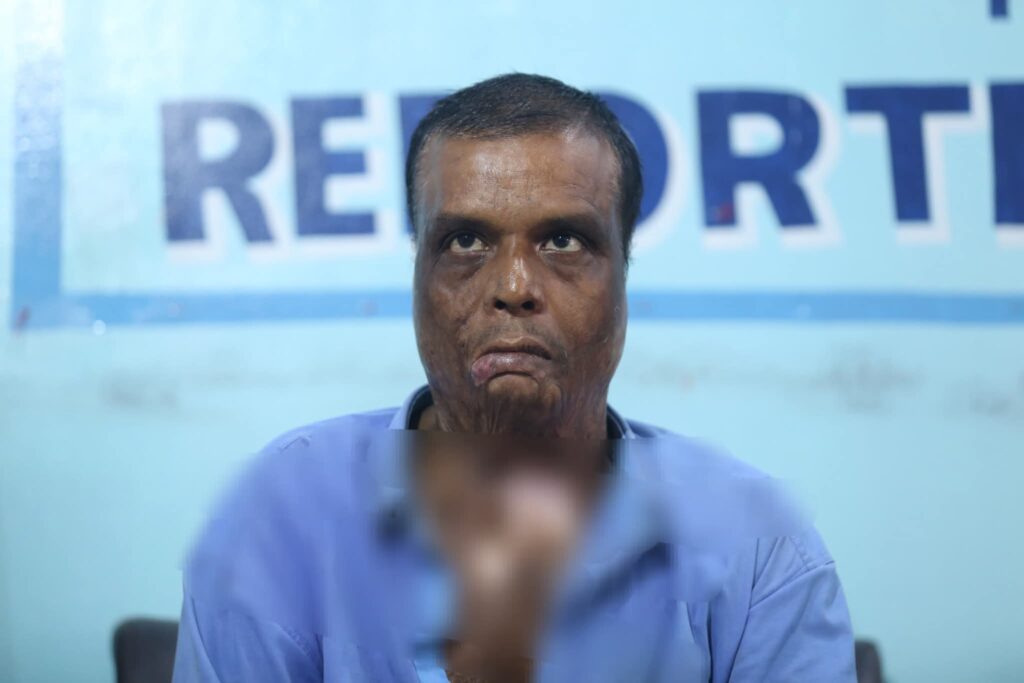 अफ्ताब आलम छुटे, बमले घाइते भएका गौरीशंकर न्याय खोज्दै काठमाडौं आइपुगे